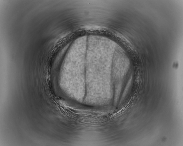 X0000098170966200805151113