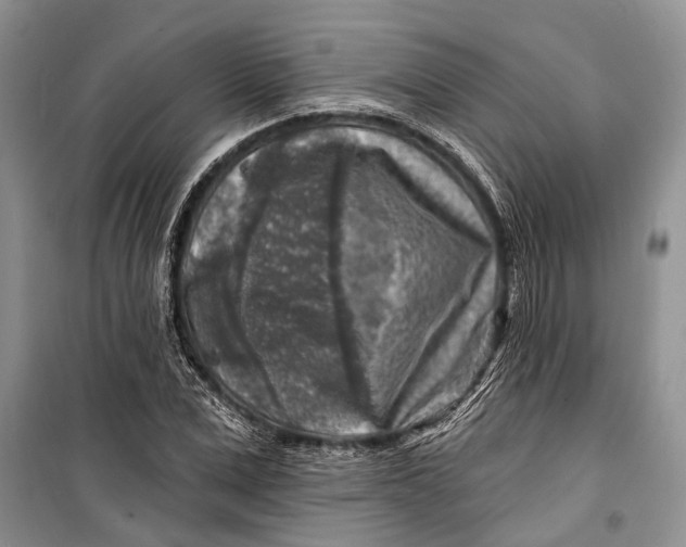 X0000098170975200805151112