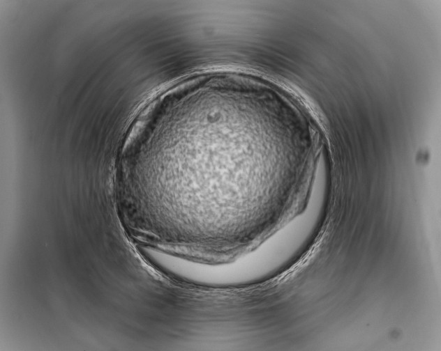 X0000098170993200805151112