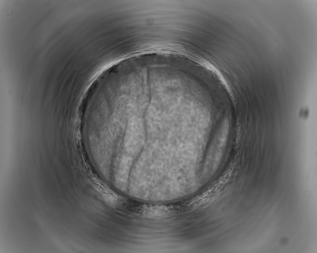 X0000098171019200805151111