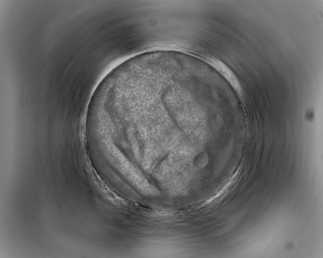 X0000098171052200805151112