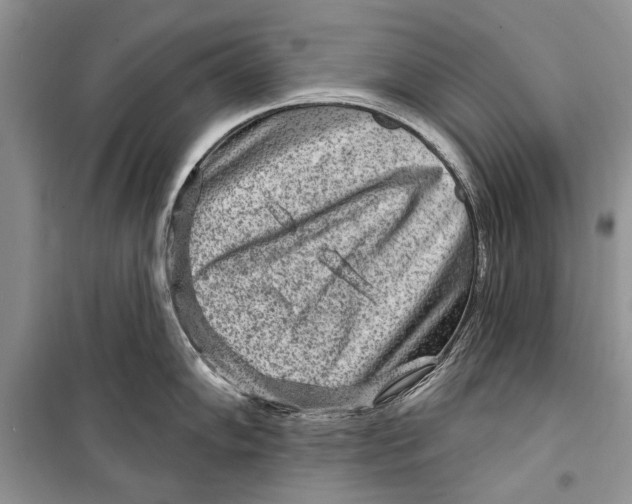 X0000098171102200805151110