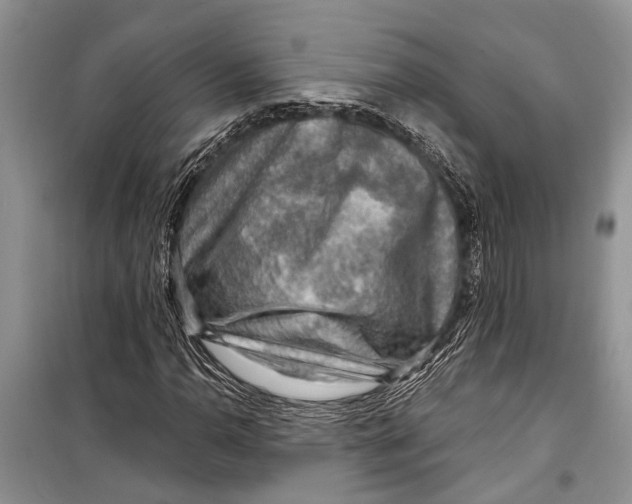 X0000098171110200805151110