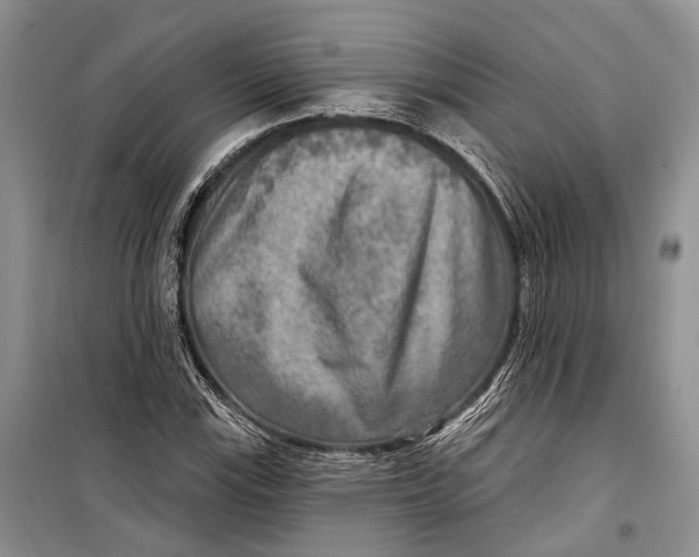 X0000098171115200805151110