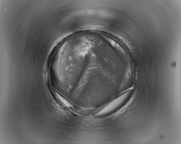 X0000098171117200805151110