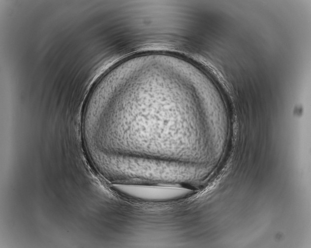 X0000098171129200805151110