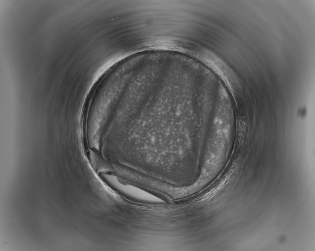 X0000098171141200805151110