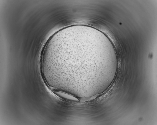 X0000098171143200805151110