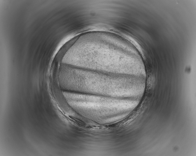 X0000098171146200805151110