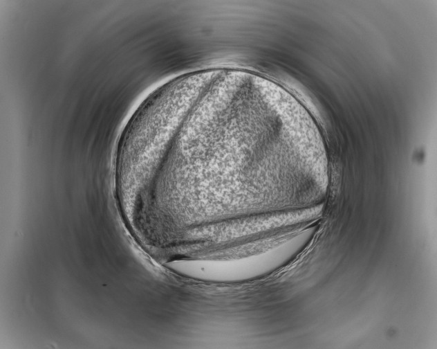 X0000098171148200805151110