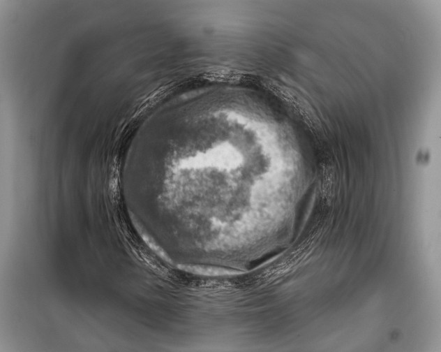 X0000098171154200805151110