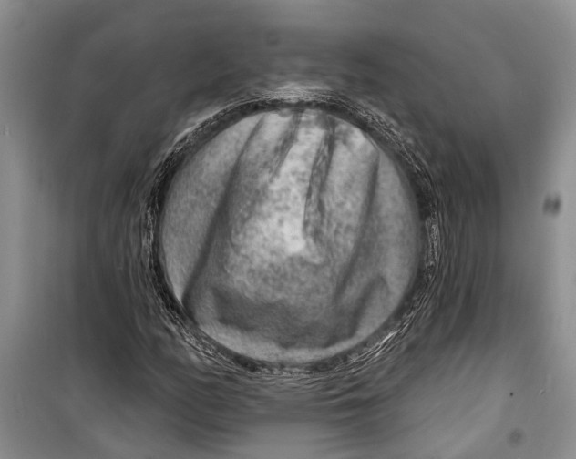 X0000098171158200805151110