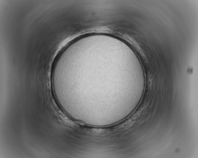 X0000098171176200805151109