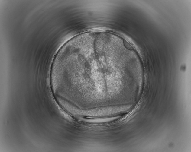 X0000098171194200805151109