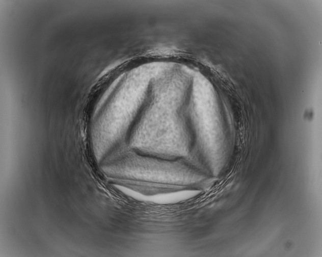 X0000098171206200805151108