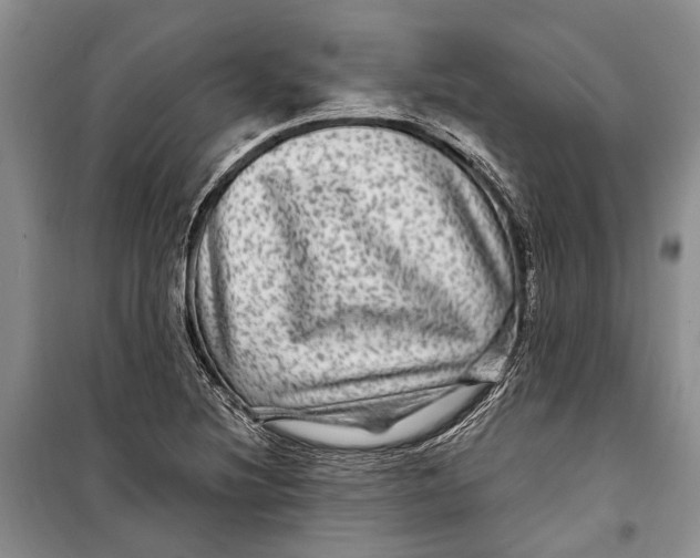 X0000098171220200805151109