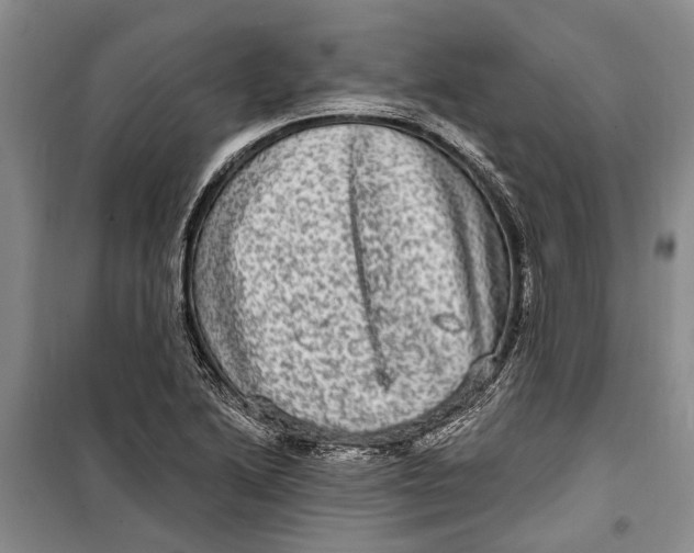 X0000098171222200805151109