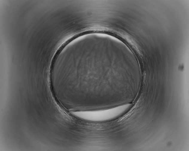 X0000098171229200805151109