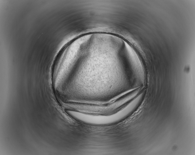 X0000098171230200805151109