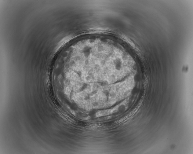 X0000098171259200805151108