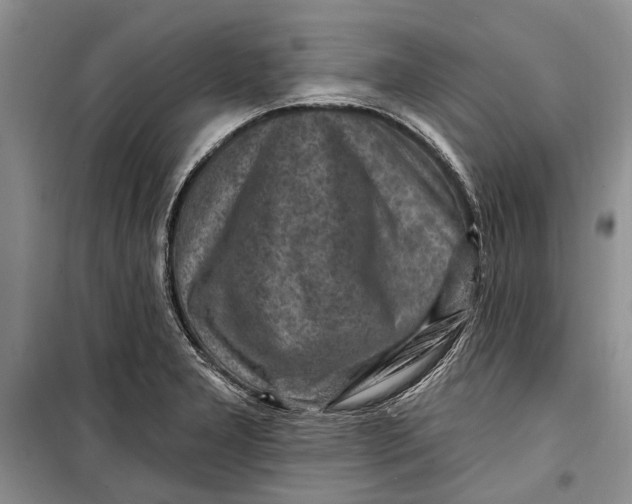 X0000098171277200805151108