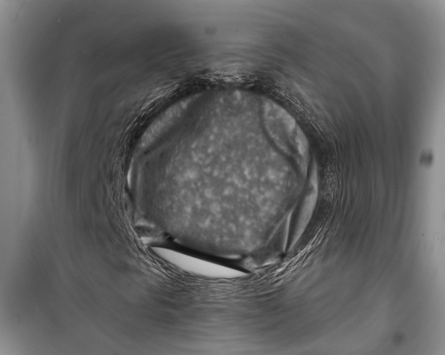 X0000098171297200805151107