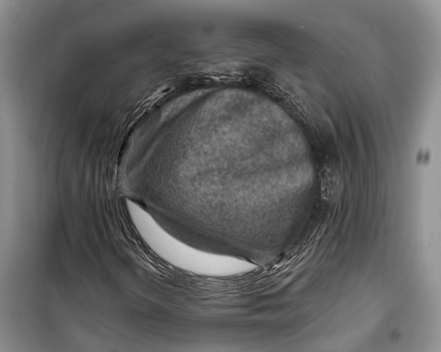 X0000098171298200805151107