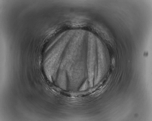 X0000098171300200805151107