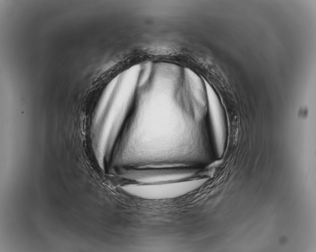 X0000098171301200805151107