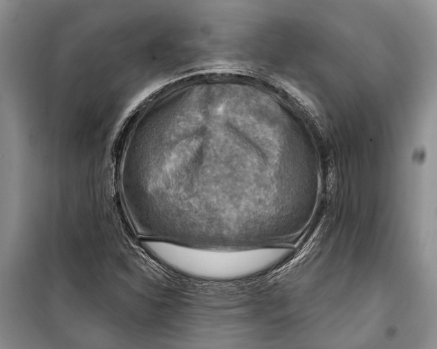 X0000098171310200805151107