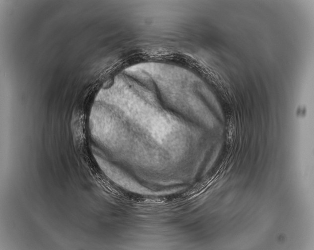 X0000098171346200805151107