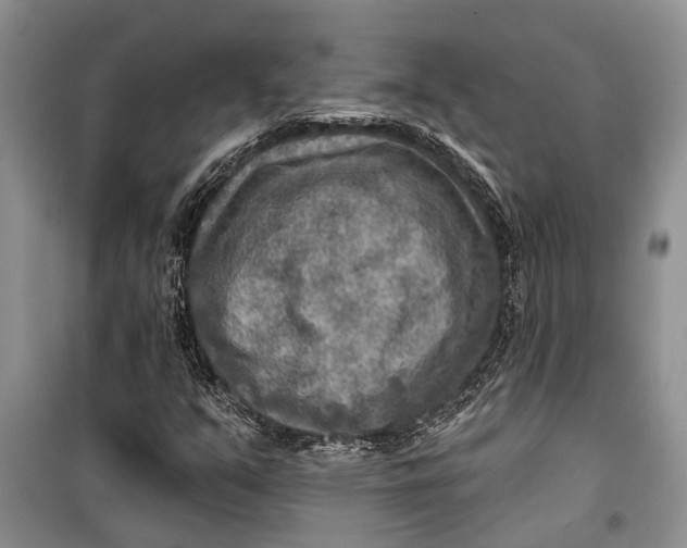 X0000098171351200805151107