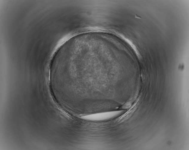 X0000098171365200805151107