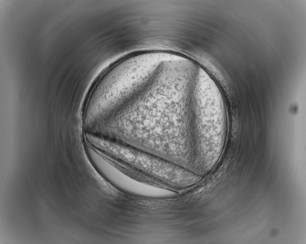 X0000098171380200805151106