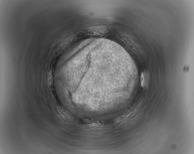 X0000098171395200805151106