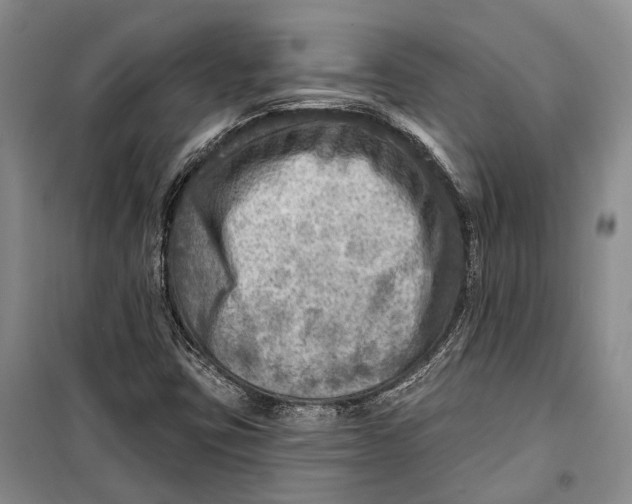 X0000098171403200805151106