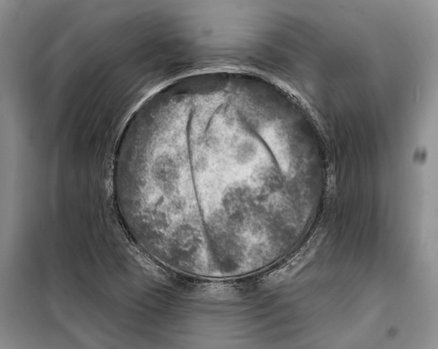 X0000098171409200805151106