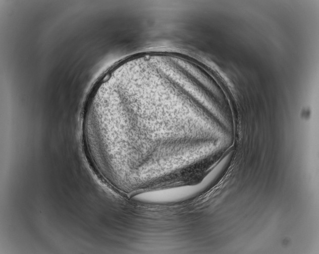 X0000098171416200805151106