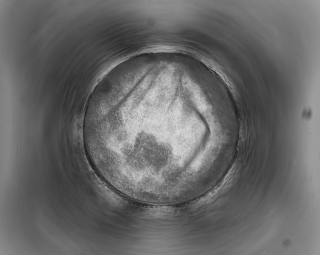 X0000098171417200805151106