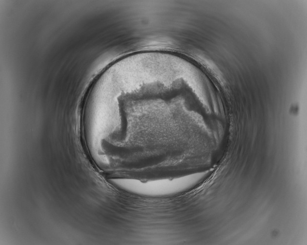 X0000098171419200805151106