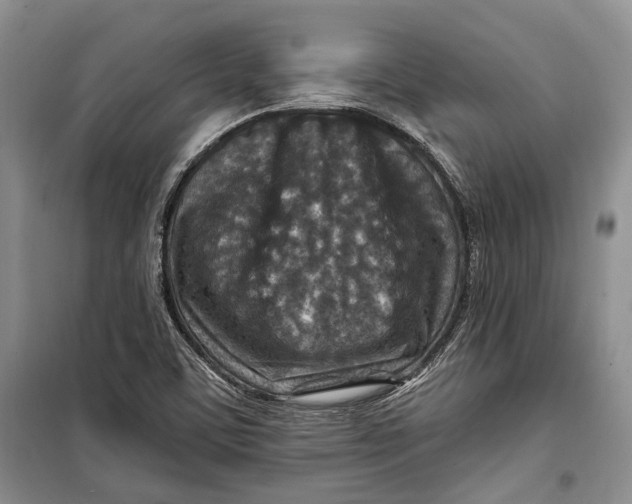 X0000098171459200805151105