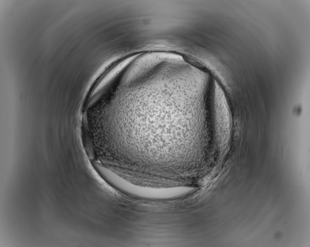 X0000098171476200805151105