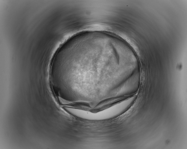 X0000098171477200805151105