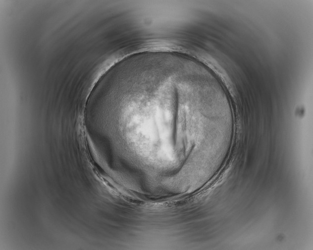 X0000098171481200805151105