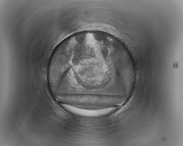 X0000098171505200805151104