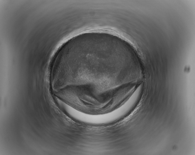 X0000098171506200805151104