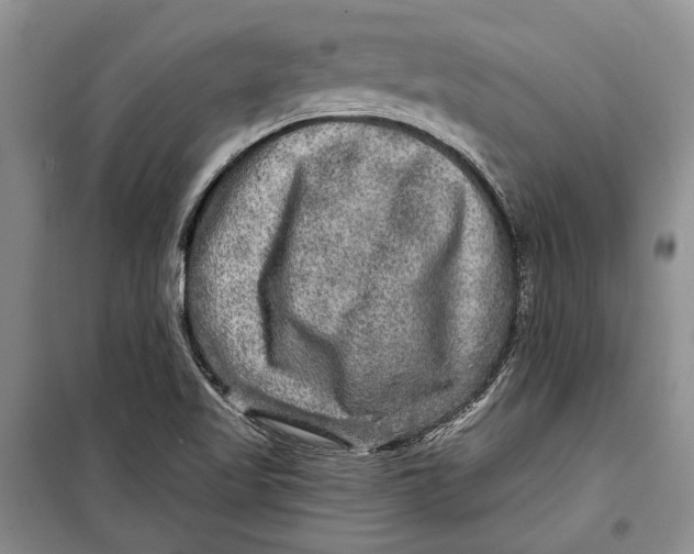 X0000098171509200805151104