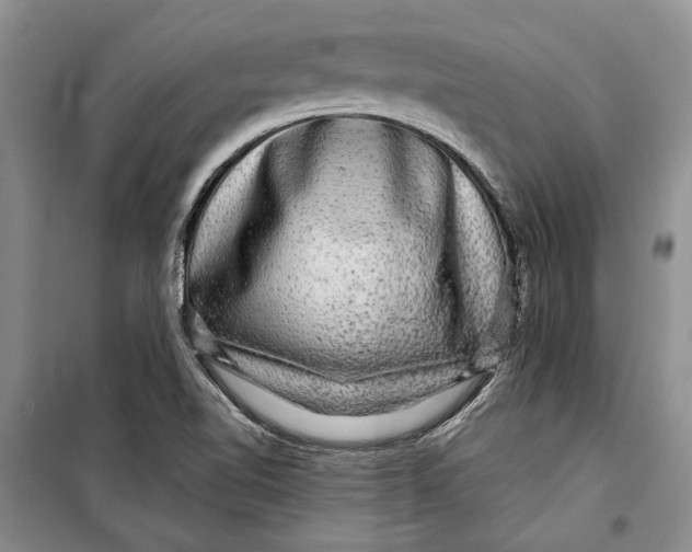 X0000098171510200805151104