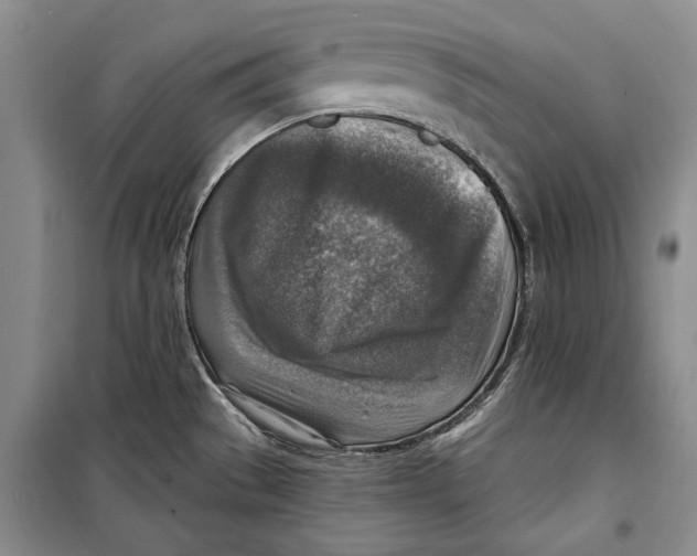 X0000098171529200805151105