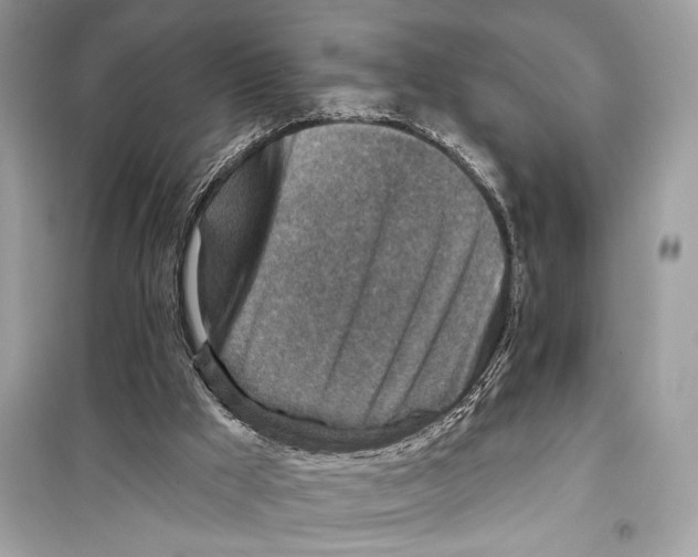 X0000098170009200805221525